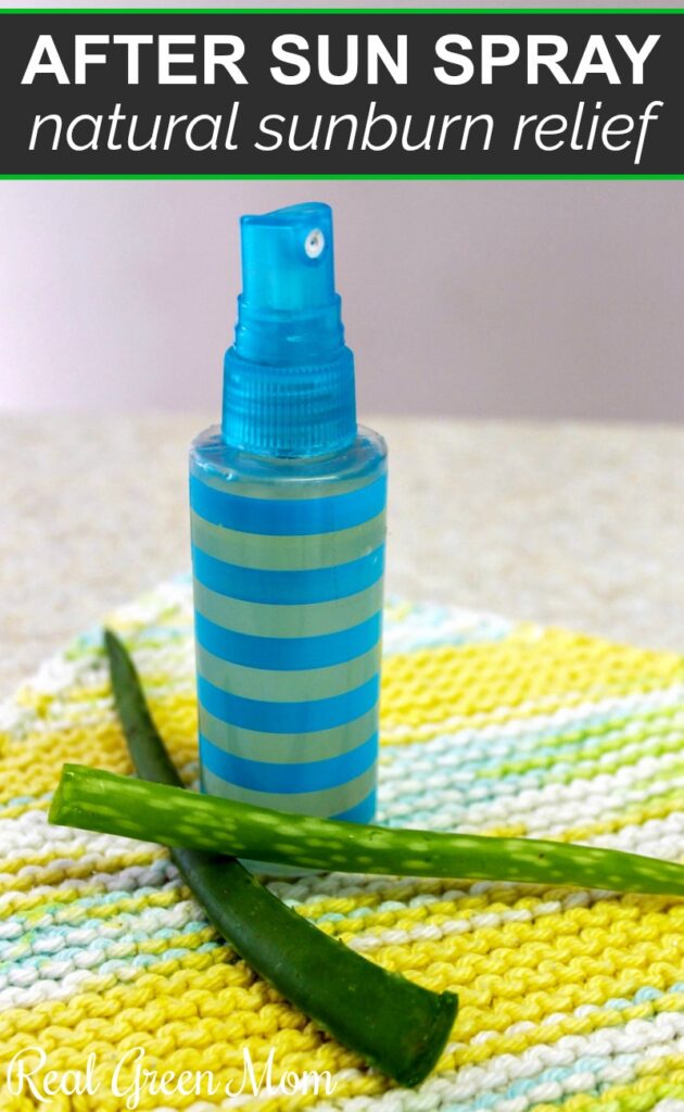 Blue and green striped spray bottle of homemade after sun aloe spray